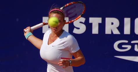 Simona Halep wants surgery to reduce the size of her ...