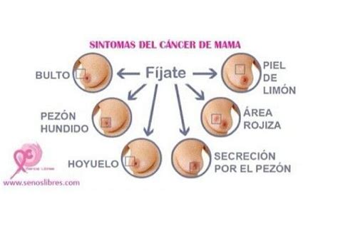 Sintomas cancer de mama ~ Ʀεƥɪииεð вƴ╭•⊰ © Ʀσxʌиʌ Ƭʌиʌ ...