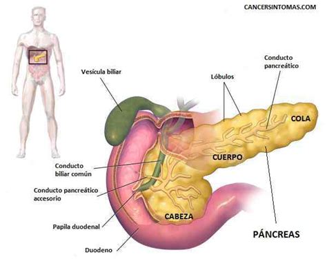 Síntomas de cáncer de páncreas: primeros, iniciales y avanzado