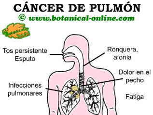 Síntomas de cáncer de pulmón