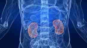 Síntomas de cáncer de riñón  renal : primeros, iniciales y ...