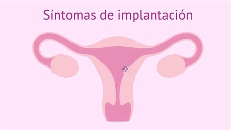 Síntomas de implantación embrionaria   clipzui.com