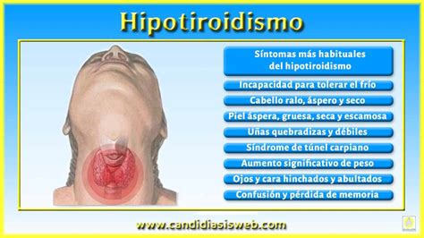 Síntomas de la candidiasis   Hipotiroidismo