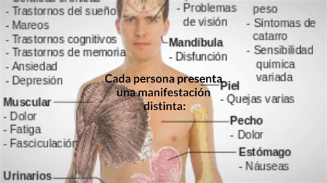 Sintomas de la fibromialgia   YouTube