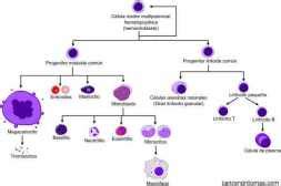 Síntomas de leucemia  cáncer en la sangre : primeros ...