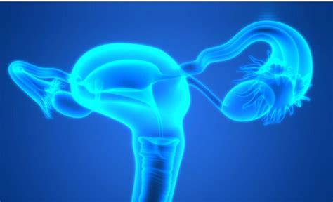 Síntomas del cáncer de cuello uterino que debes conocer
