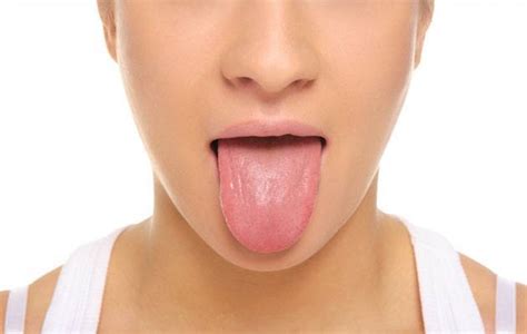 Síntomas del cáncer de lengua   Demedicina.com