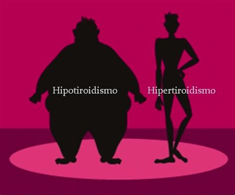 Síntomas del Hipertiroidismo: qué es, causas y tratamiento ...