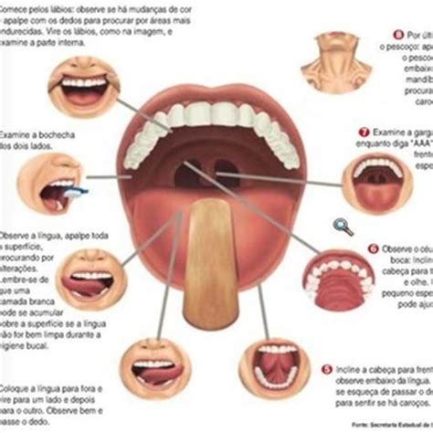 Sintomas do câncer de boca   Notícias   Dentflex ...