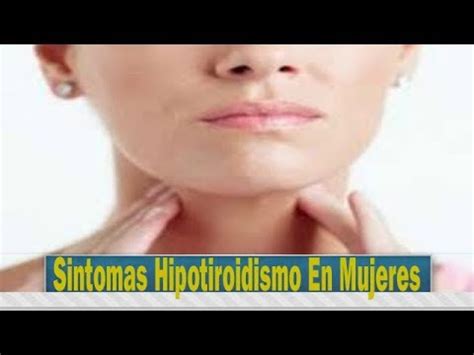 Sintomas Hipotiroidismo En Mujeres   YouTube