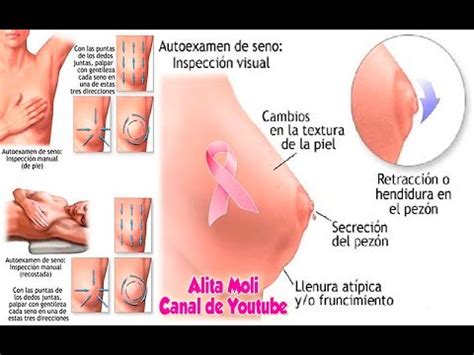 Síntomas y diagnóstico del cáncer de mama YouTube