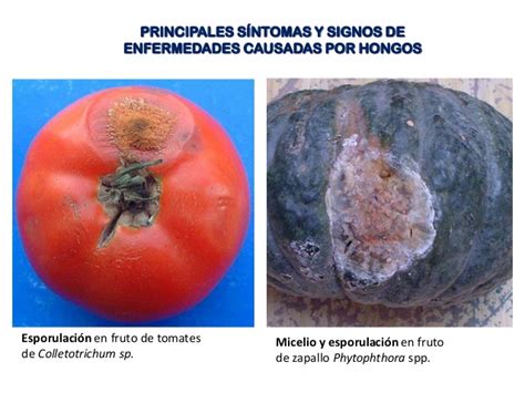 Sintomas y signos causados por hongos