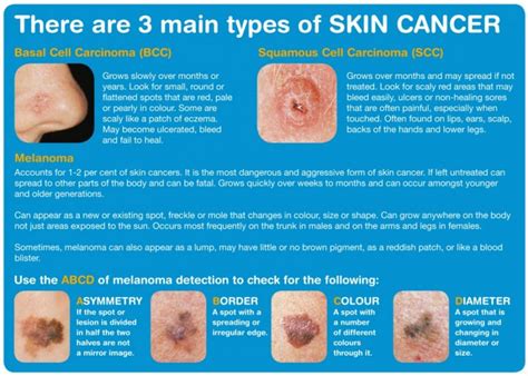 Skin Cancer Awareness   Mum, Thats Me