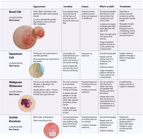 Skin Cancer & Melanoma: Causes, Symptoms, Treatment ...