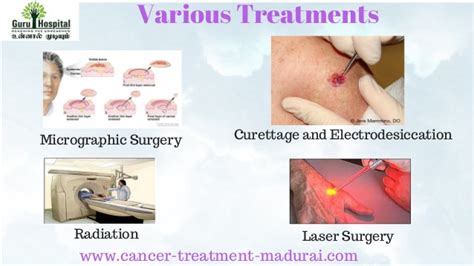 Skin Cancer Treatment in Tamil Nadu | Cancer Treatment ...