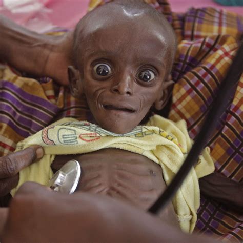 Somali Children Need Your Help! « Worldorphanrelief’s Weblog