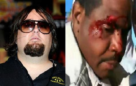 ‘Pawn Stars’ Chumlee Involved in Bloody Fight in Hollywood ...