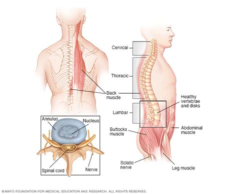 Spinal Tumors  Types and Treatment: All You Need To Know ...