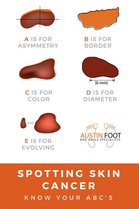 Spotting Skin Cancer | Austin Foot And Ankle Specialists