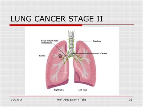 stage 1 melanoma pictures   pictures, photos