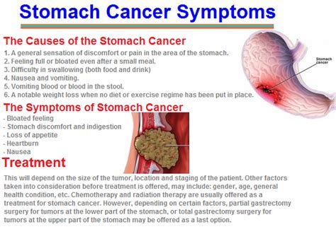 stomach cancer symptoms | menstrualcrampss