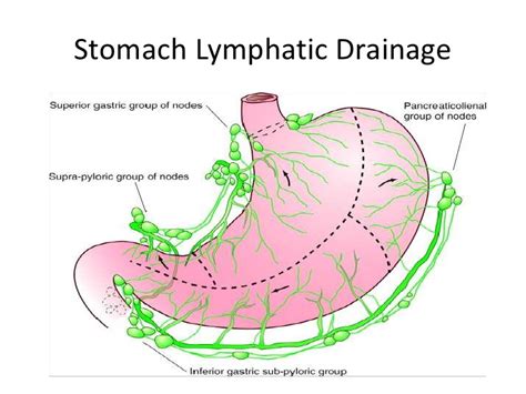 stomach lesser curve lymph nodes   Google Search ...