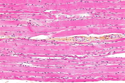 Striated muscle tissue   Wikipedia