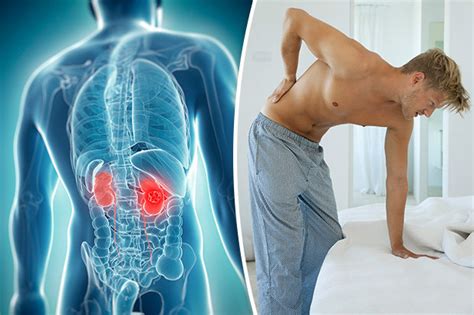 Symptoms of kidney cancer: 12 early warning signs of the ...