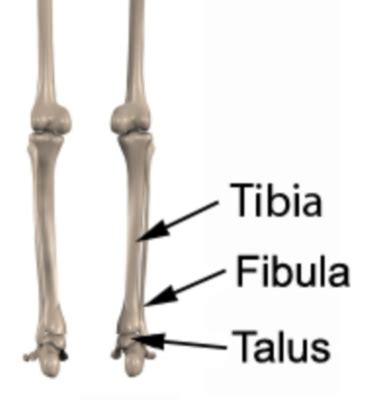Talus Fracture   Broken Talus   PhysioAdvisor