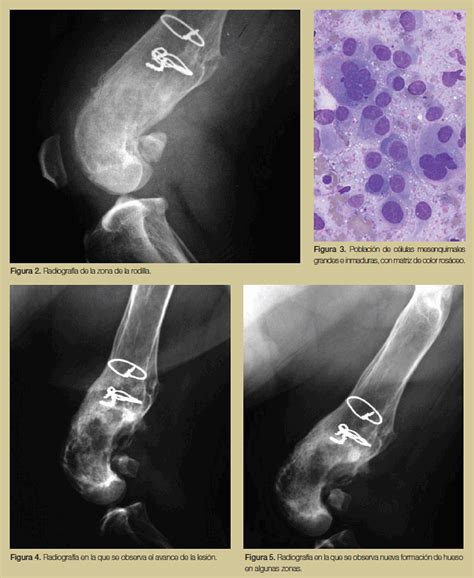 Terapia paliativa en el osteosarcoma canino | Argos Portal ...