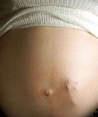 Tercer trimestre de embarazo | MURCIAMAR