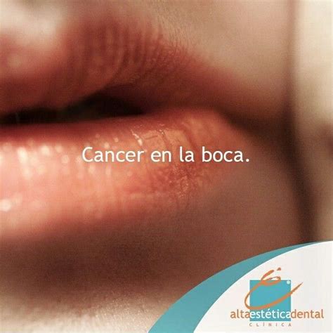 The 25+ best Cancer de boca sintomas ideas on Pinterest ...