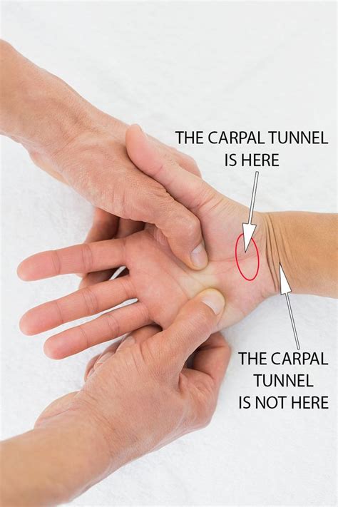 The Carpal Tunnel is at the base of the hand, not in the ...