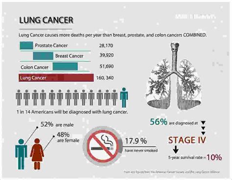 THE CAUSES AND THE TREATMENTS OF ASBESTOS LUNG CANCER ...