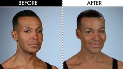 The Craziest Plastic Surgery Cases That Have Taken Place ...