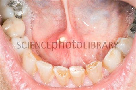 The gallery for   > Submandibular Gland Relations