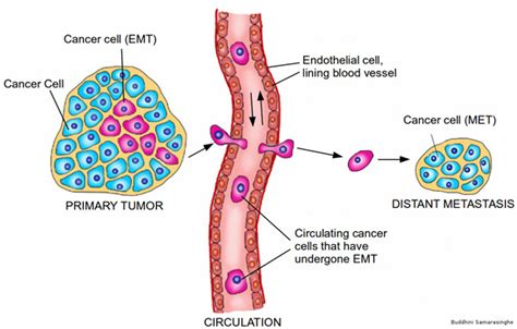 The Hallmarks of Cancer 6: Tissue Invasion and Metastasis ...
