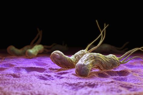 The Link Between H. pylori and Peptic Ulcers