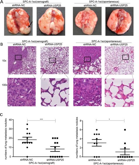The promoter roles of USP25 on lung metastasis in vivo.  A ...