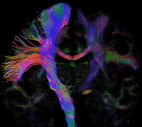 These Psychedelic GIFs Show the Future of Brain Mapping ...