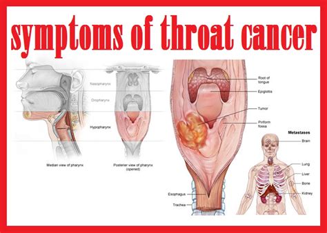 throat cancer info