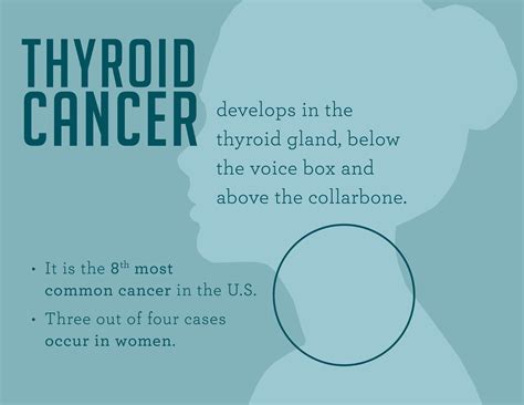 Thyroid Cancer Symptoms In Women | www.pixshark.com ...