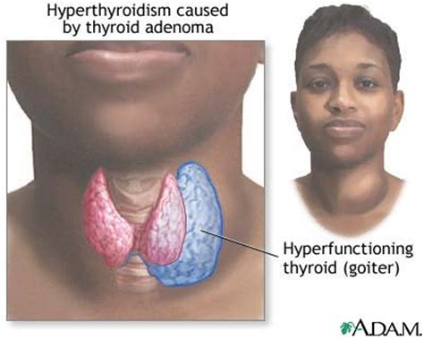 Thyroid hormones   Women Health Info Blog