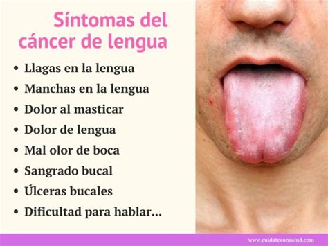 Tipos De Cancer En La Boca | tabaquismo y sus ...