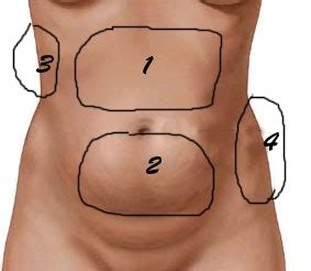 Tipos de gordura abdominal