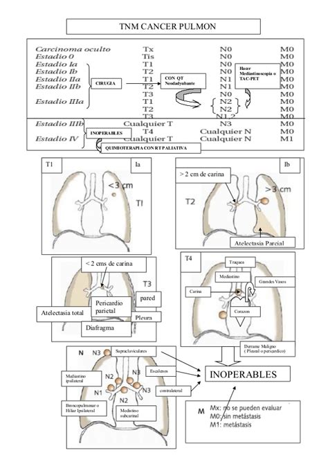 Tnm cancer pulmon