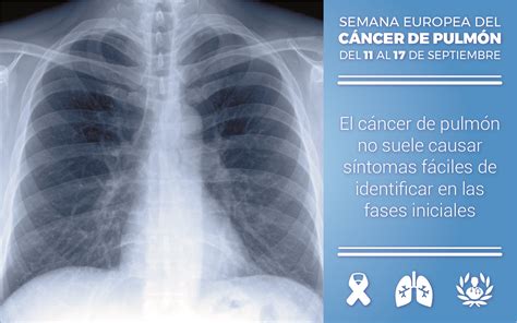 Todo lo que debes saber sobre el cáncer de pulmón | Blog
