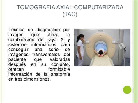 Tomografia axial computarizada  TAC , TOMOGRAFIA ...