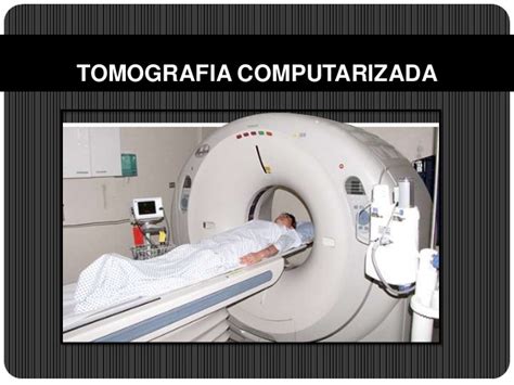 Tomografia computarizada medios de contraste