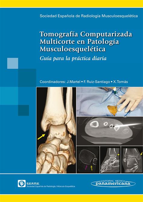 Tomografía Computarizada Multicorte en Patología ...
